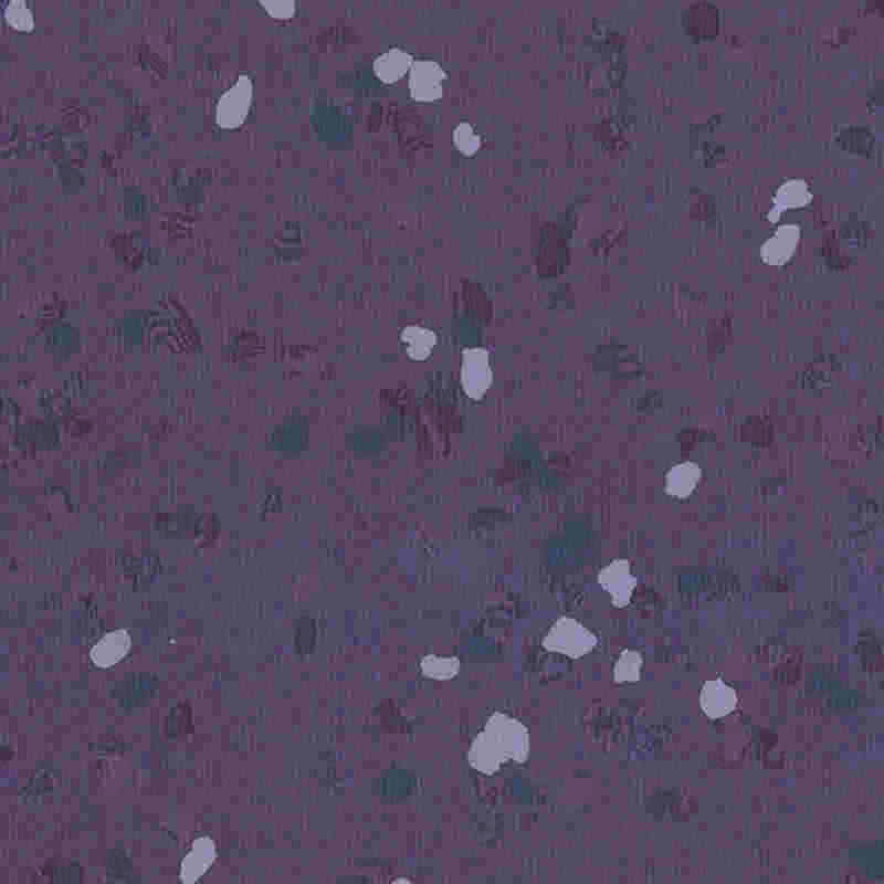 Pavimentazione in gomma antigraffio e ad alta elasticità